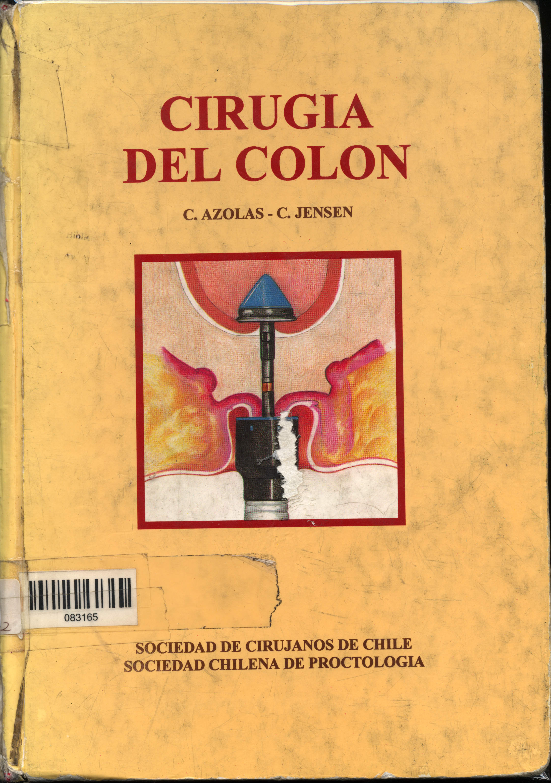 Cirugia del colon