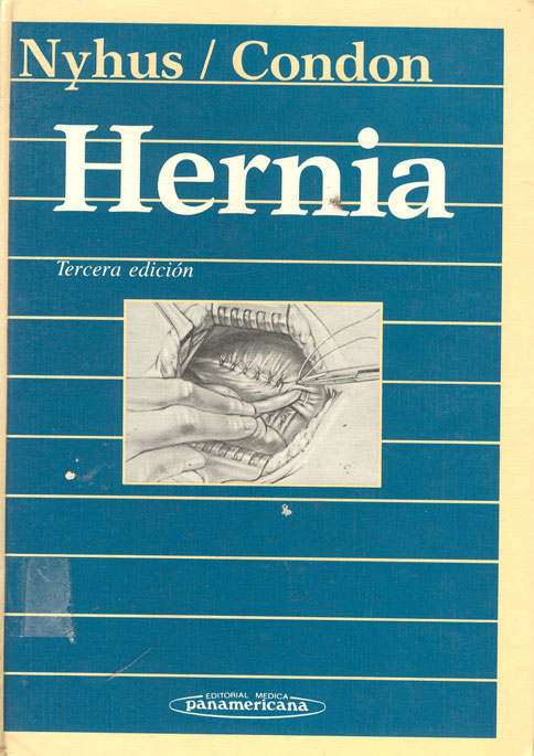 Hernia