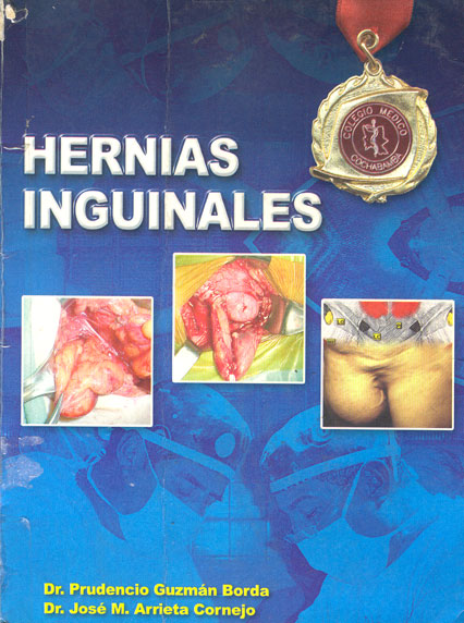 Hernias Inguinales