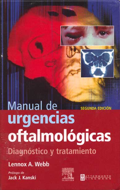 Manual de urgencias oftalmológicas diagnóstico y tratamiento