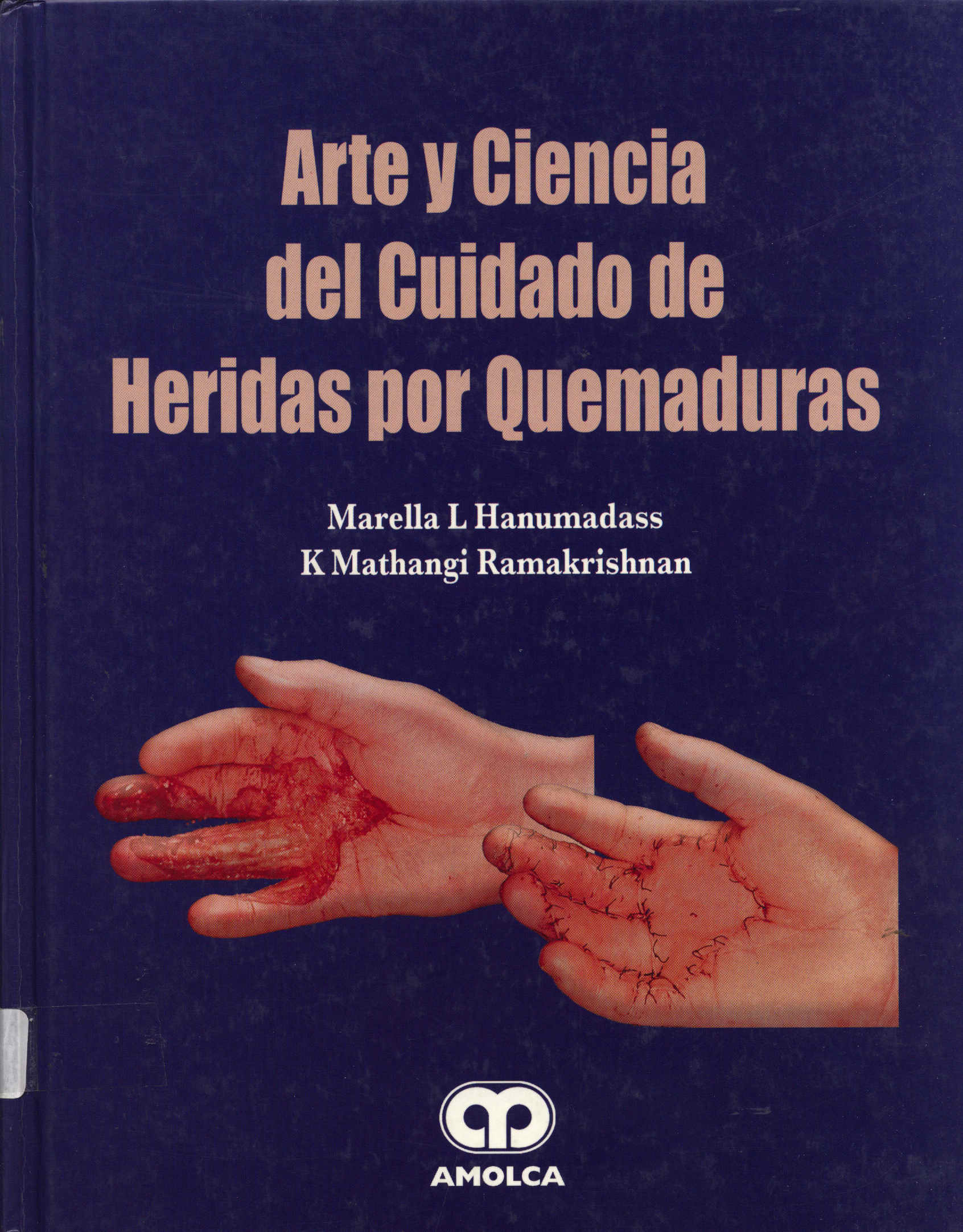 Arte y ciencia del cuidado de heridas por quemaduras