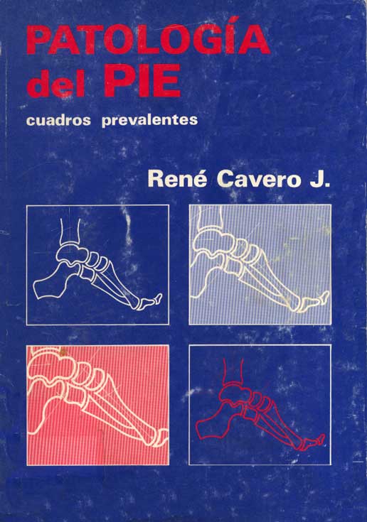 Patología del pie
