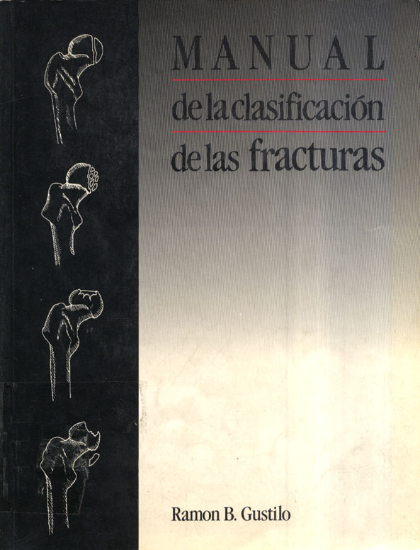 Manual de la clasificación de las fracturas