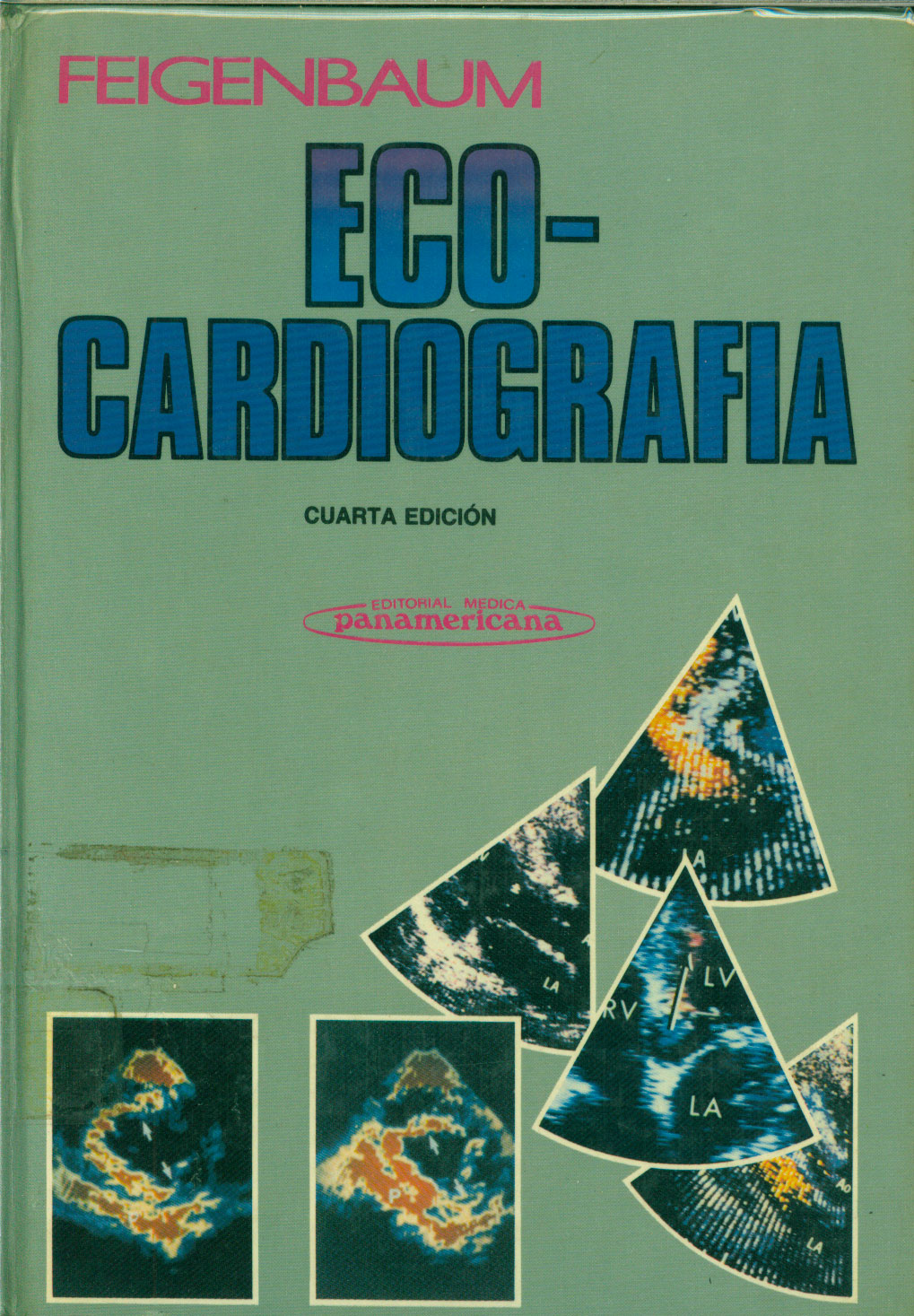 Eco Cardiografia