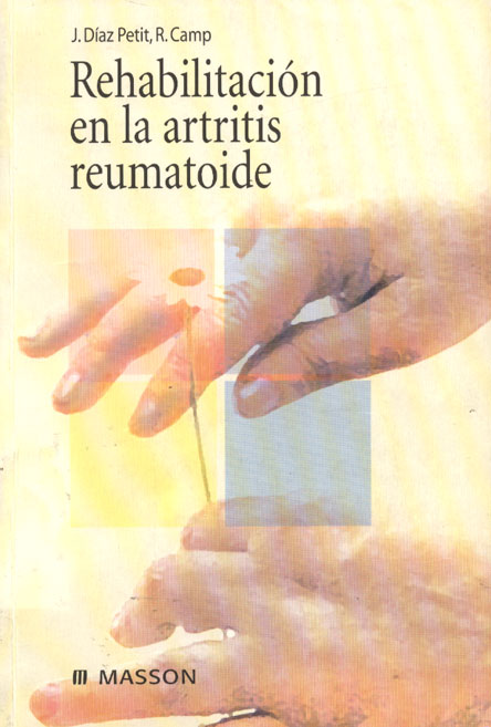 Rehabilitación en la artritis reumatoide