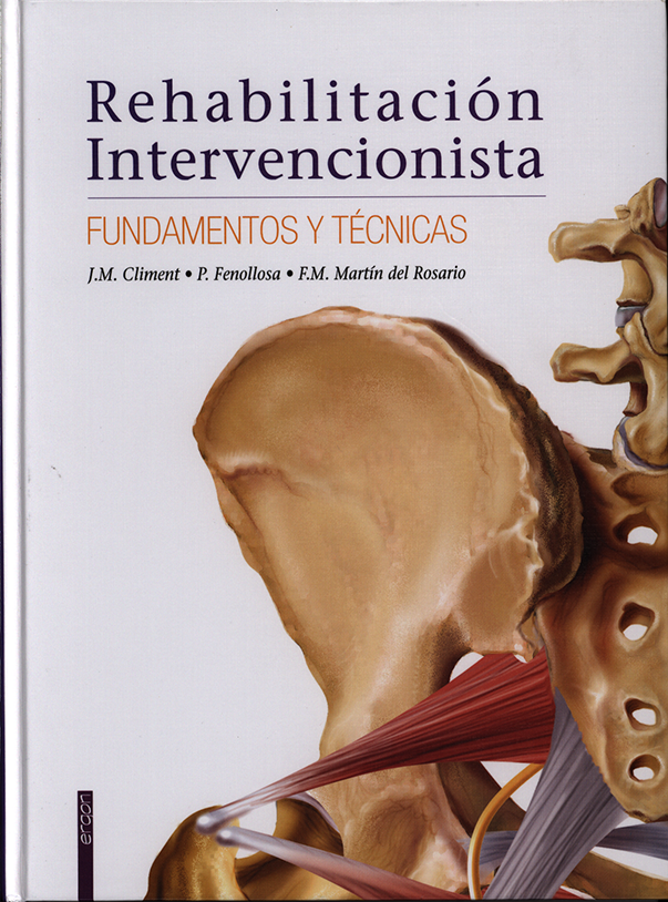 Rehabilitación Intervencionista
      <i>es</i>