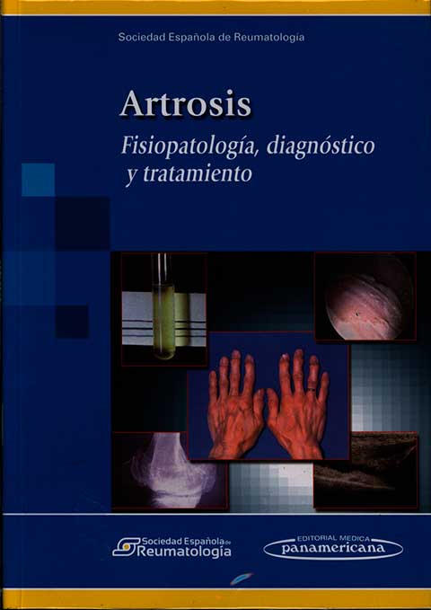 Artrosis: fisiopatologia, diagnóstico y tratamiento
      <i>es</i>