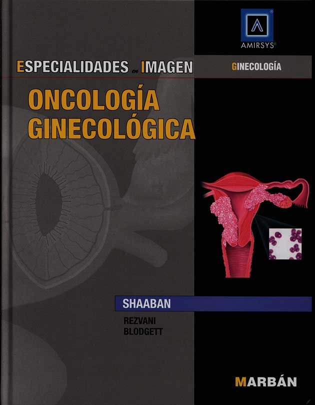 Oncologia ginecológica
      <i>es</i>
