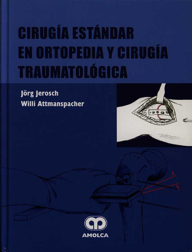 Cirugia estandar en ortopedia y cirugya traumatológica
      <i>es</i>