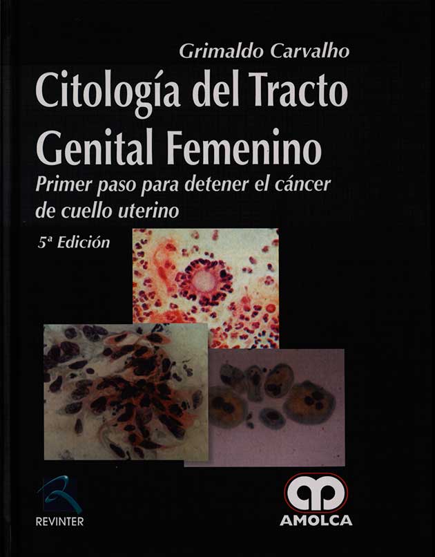 Citologia del tracto genital femenino: primer paso para detener el cancer de cuello uterino
      <i>es</i>
