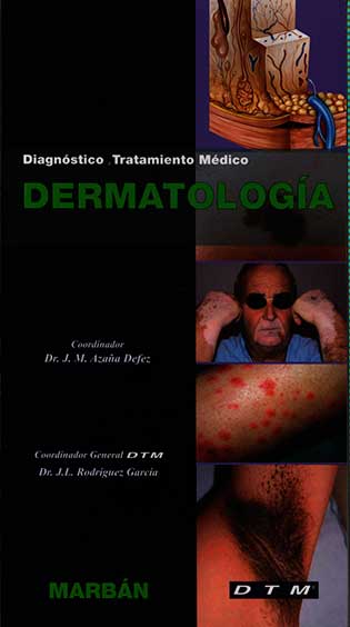 Diagnóstico, Tratamiento Medico Dermatologia
      <i>es</i>