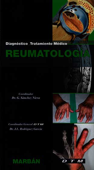 Diagnóstico, Tratamiento Medico Reumatologia
      <i>es</i>
