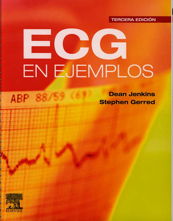ECG en ejemplos
      <i>es</i>