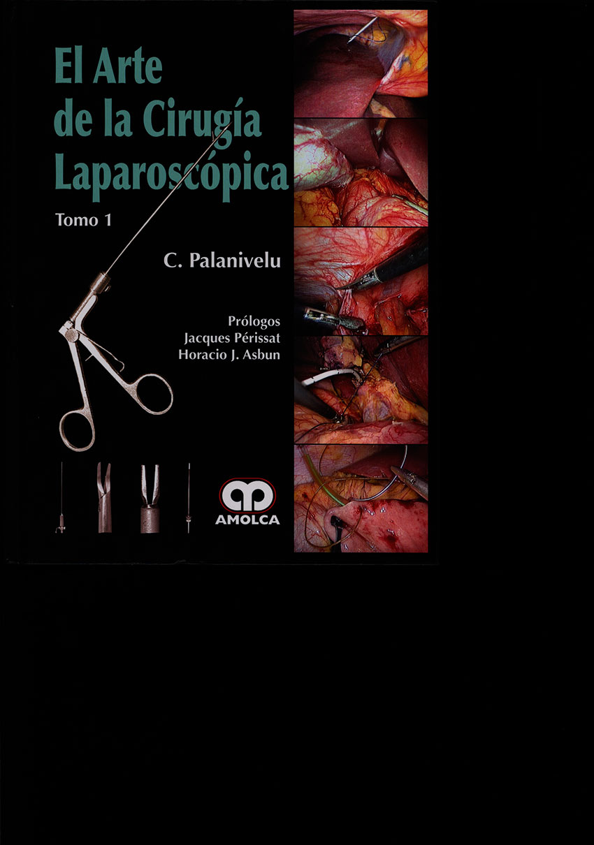 El arte de la cirugia laparoscópica
      <i>es</i>
