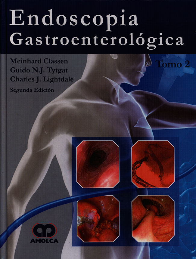 Endoscopia gastroenterológica