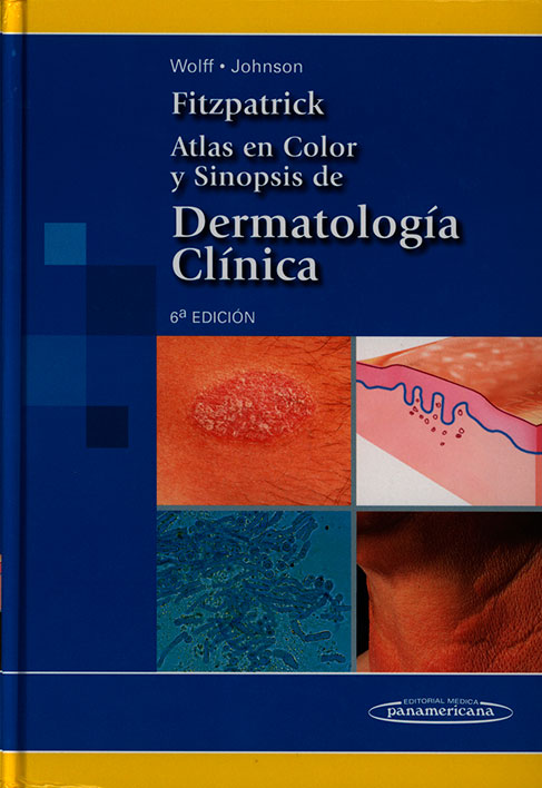 Fitzpatrick atlas en color y sinopsis de dermatologia clinica
      <i>es</i>