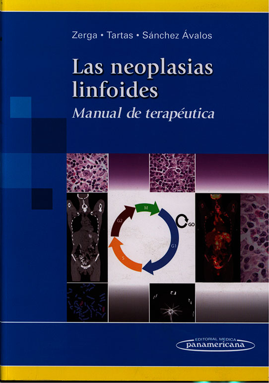 Las neoplasias linfoides: manual de terapeutica
      <i>es</i>