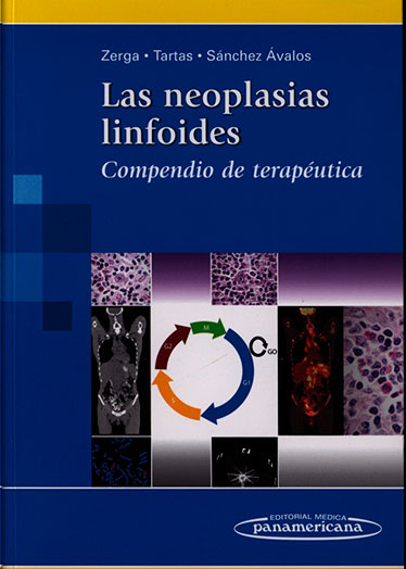 Las neoplasias linfoides: compendio de terapeutica
      <i>es</i>