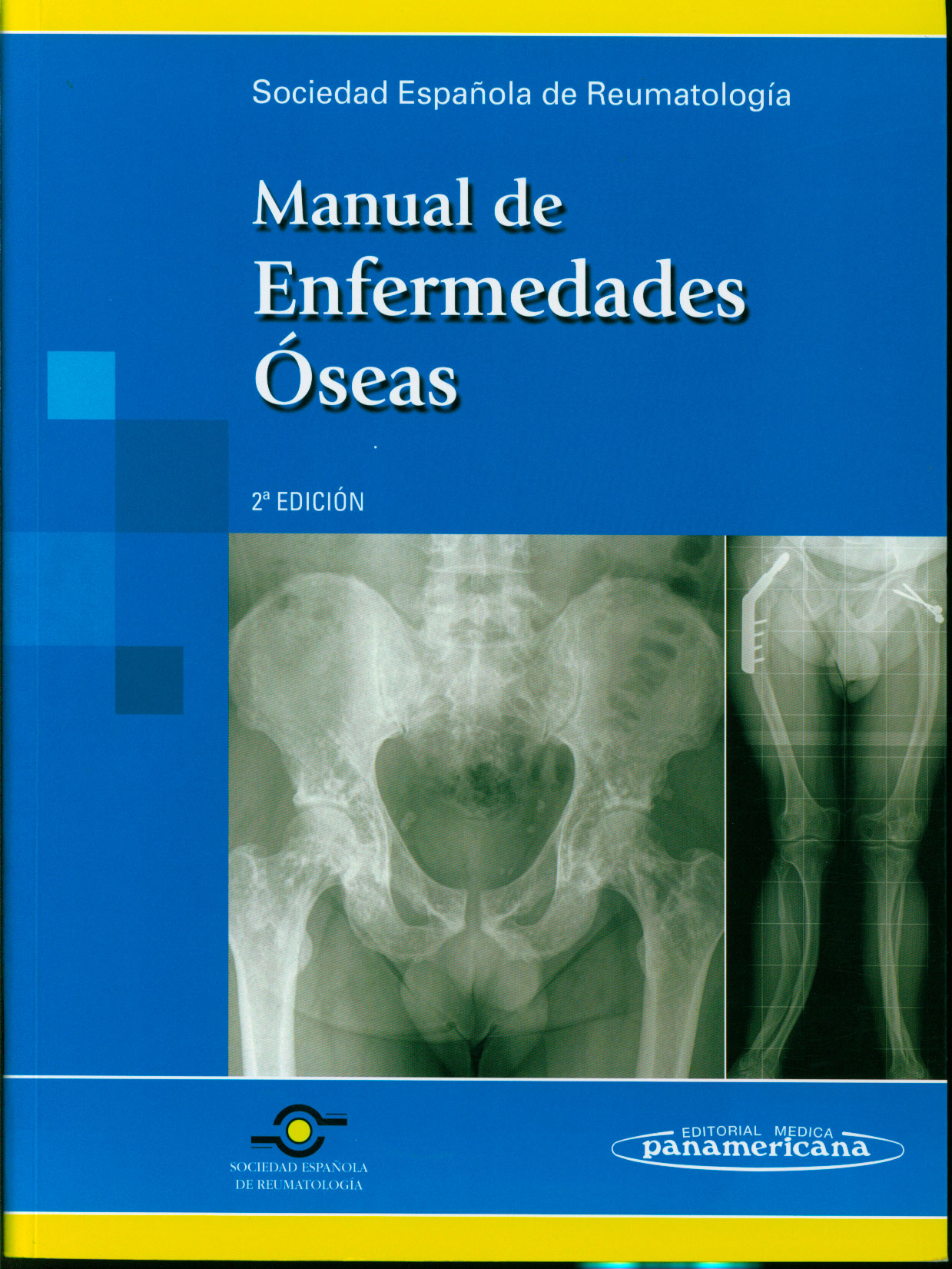 Manual de enfermedades óseas
      <i>es</i>