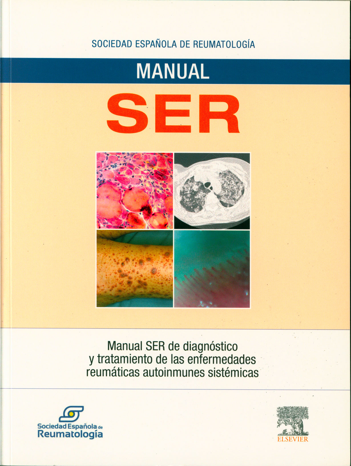 Manual ser de diagnóstico y tratamiento de las enfermedades reumaticas autoinmunes sistemicas
      <i>es</i>