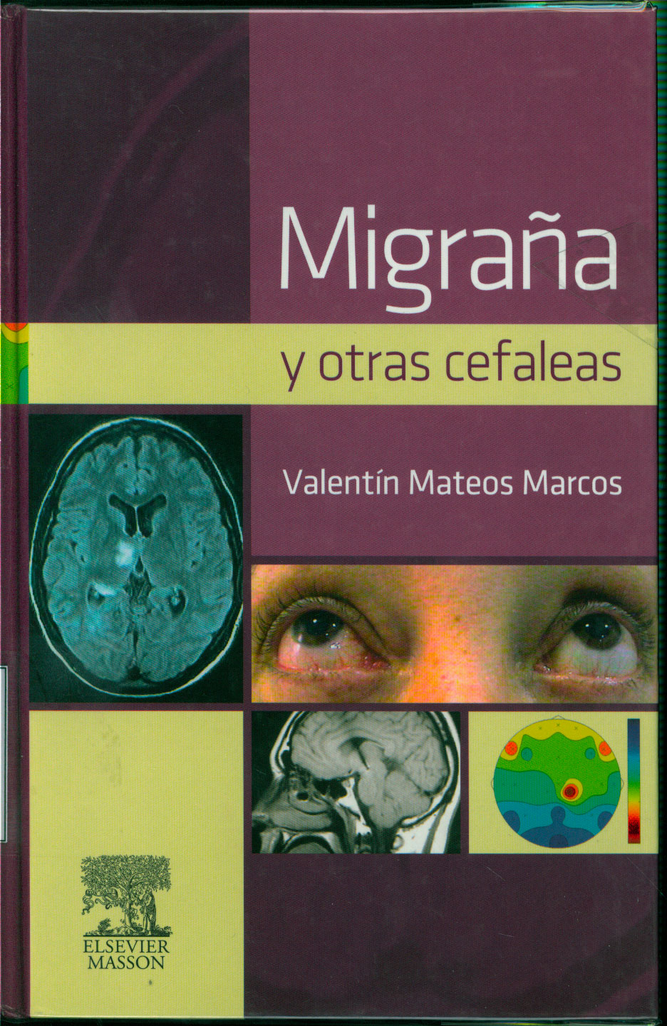 Migraña y otras cefaleas
      <i>es</i>