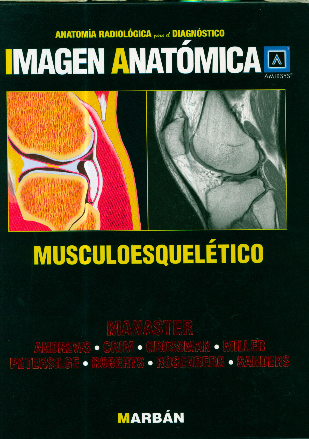 Musculoesqueletico: anatomia radiológica para el diagnóstico
      <i>es</i>