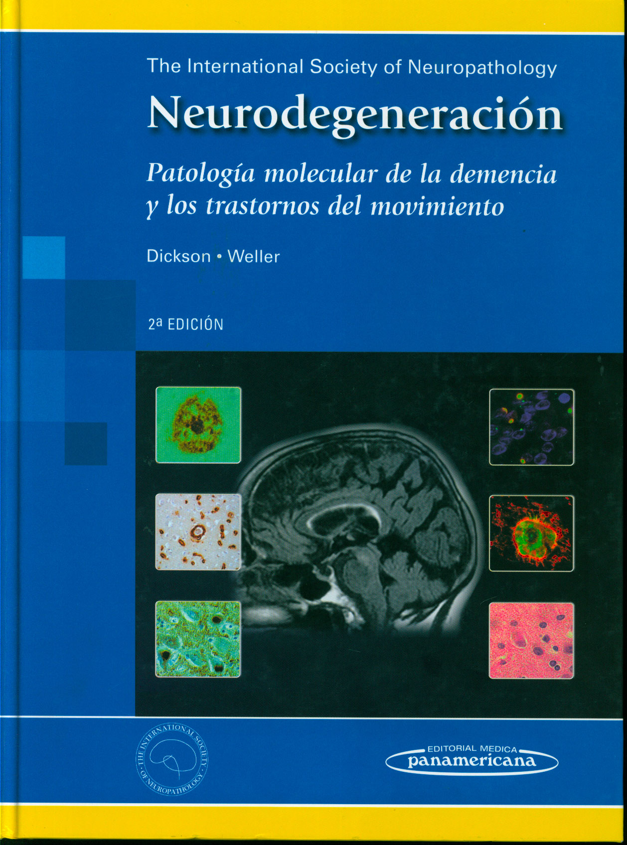 Neurodegeneración: patologia molecular de la demencia y los trastornos del movimiento
      <i>es</i>