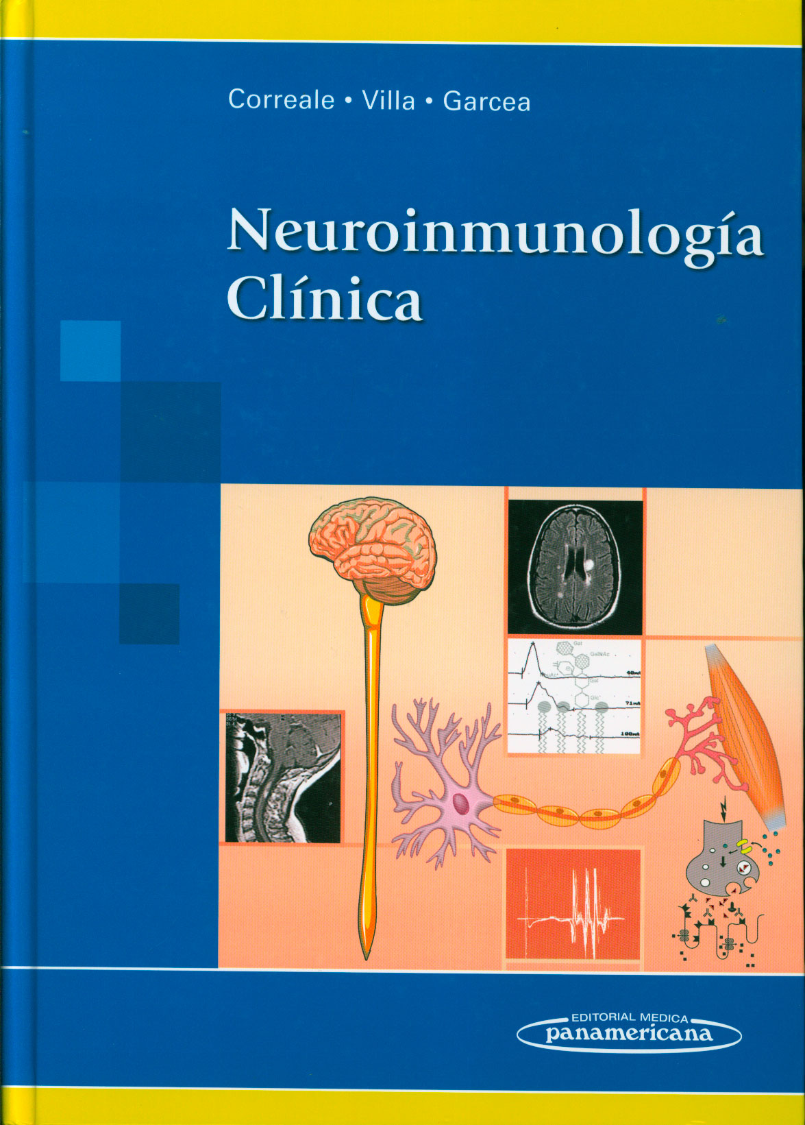 Neuroinmunologia clinica
      <i>es</i>