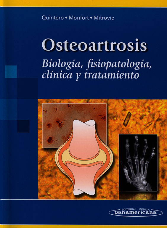 Osteoartrosis: biologia, fisiopatologia, clinica y tratamiento
      <i>es</i>