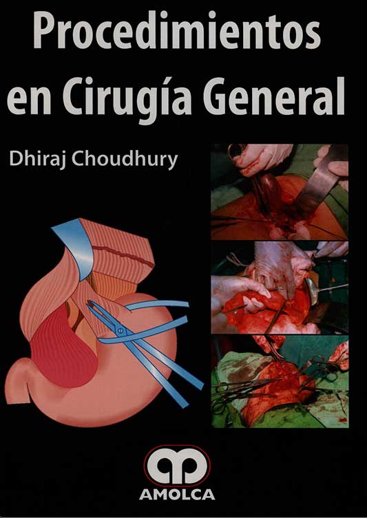 Procedimientos en cirugia general
      <i>es</i>