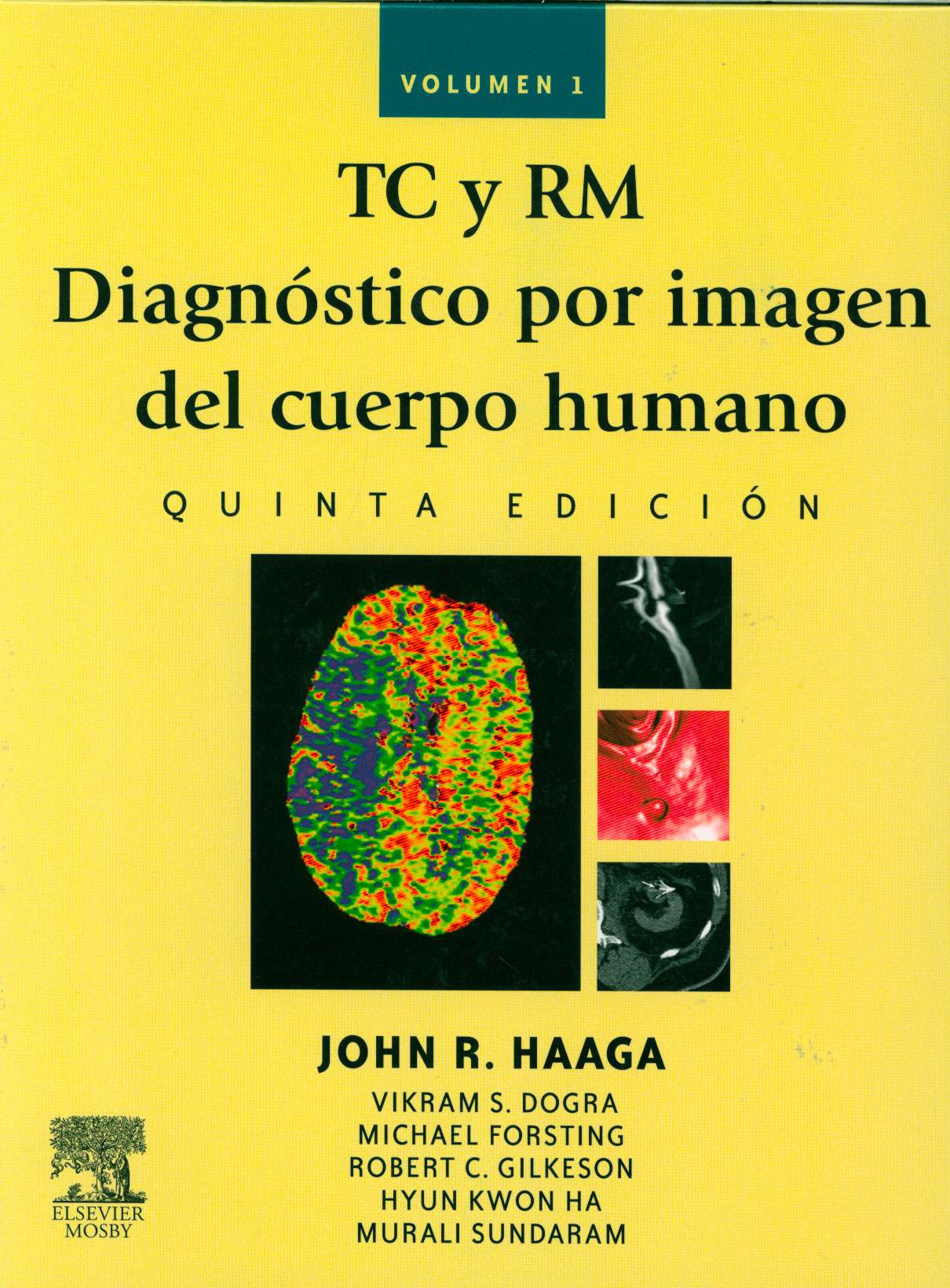 TC y RM diagnóstico por imagen del cuerpo humano
      <i>es</i>