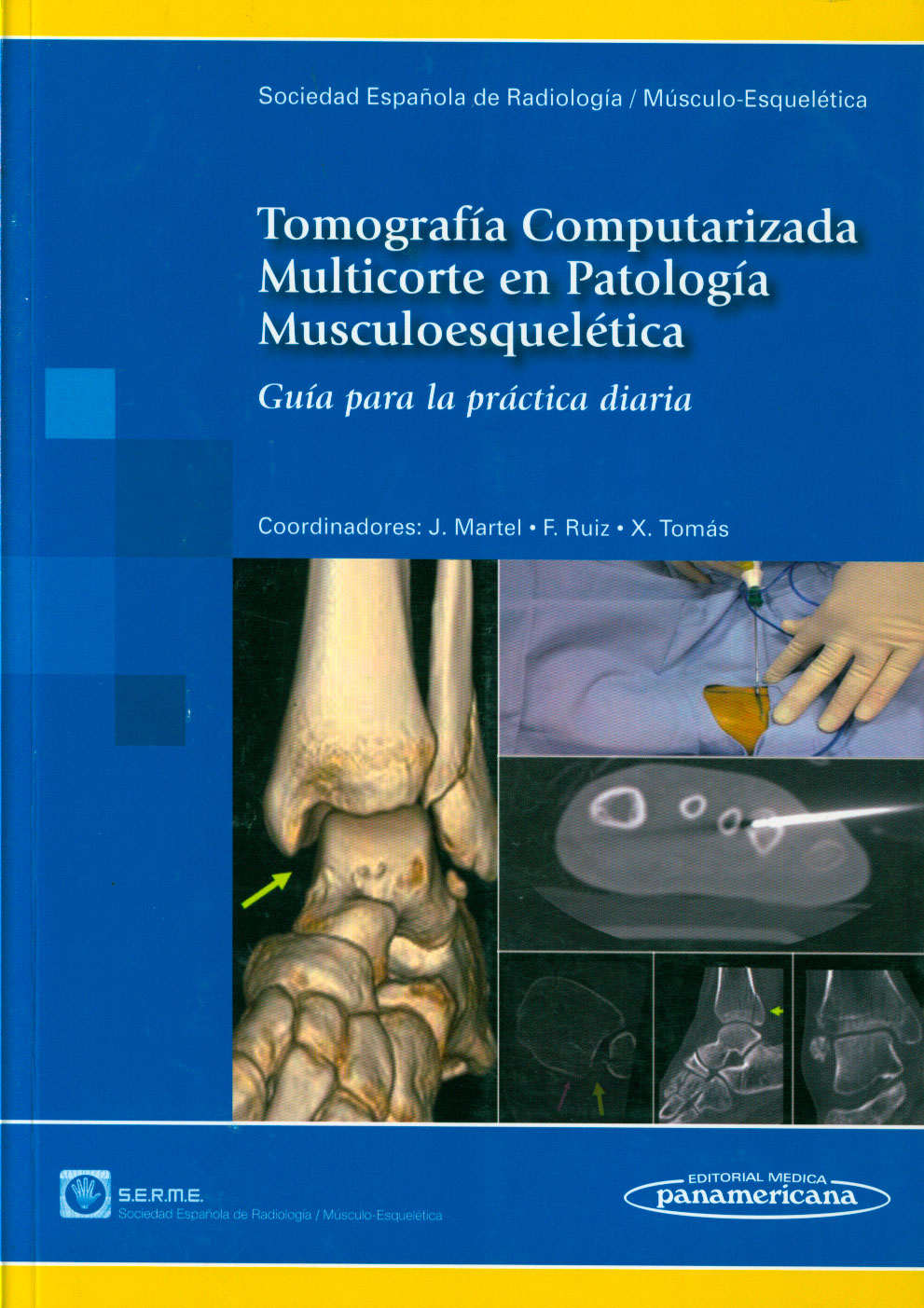 Tomografia computarizada multicorte en patologia musculoesqueletica: guia para la practica diaria
      <i>es</i>