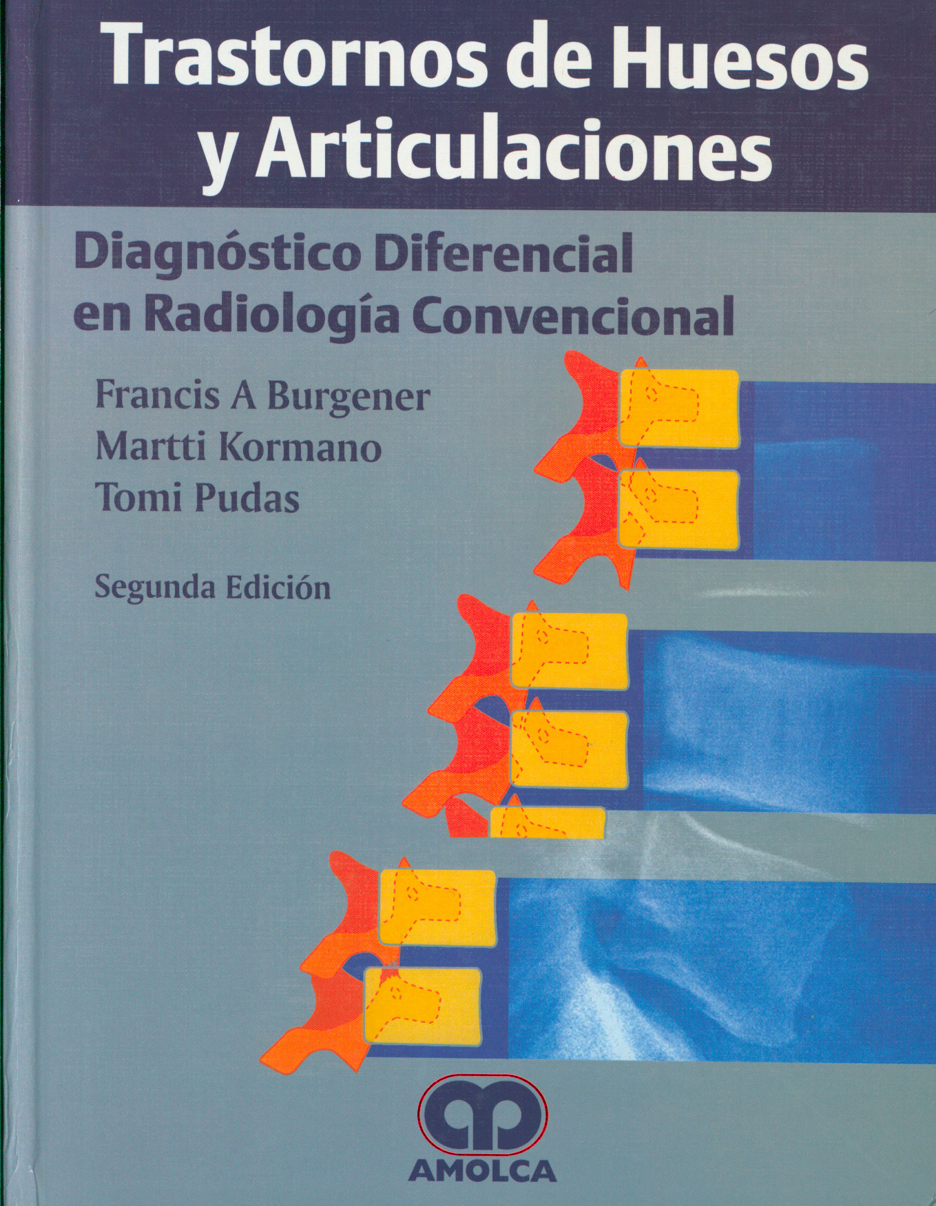 Trastornos de huesos y articulaciones: diagnóstico diferencial en radiología convencional
      <i>es</i>