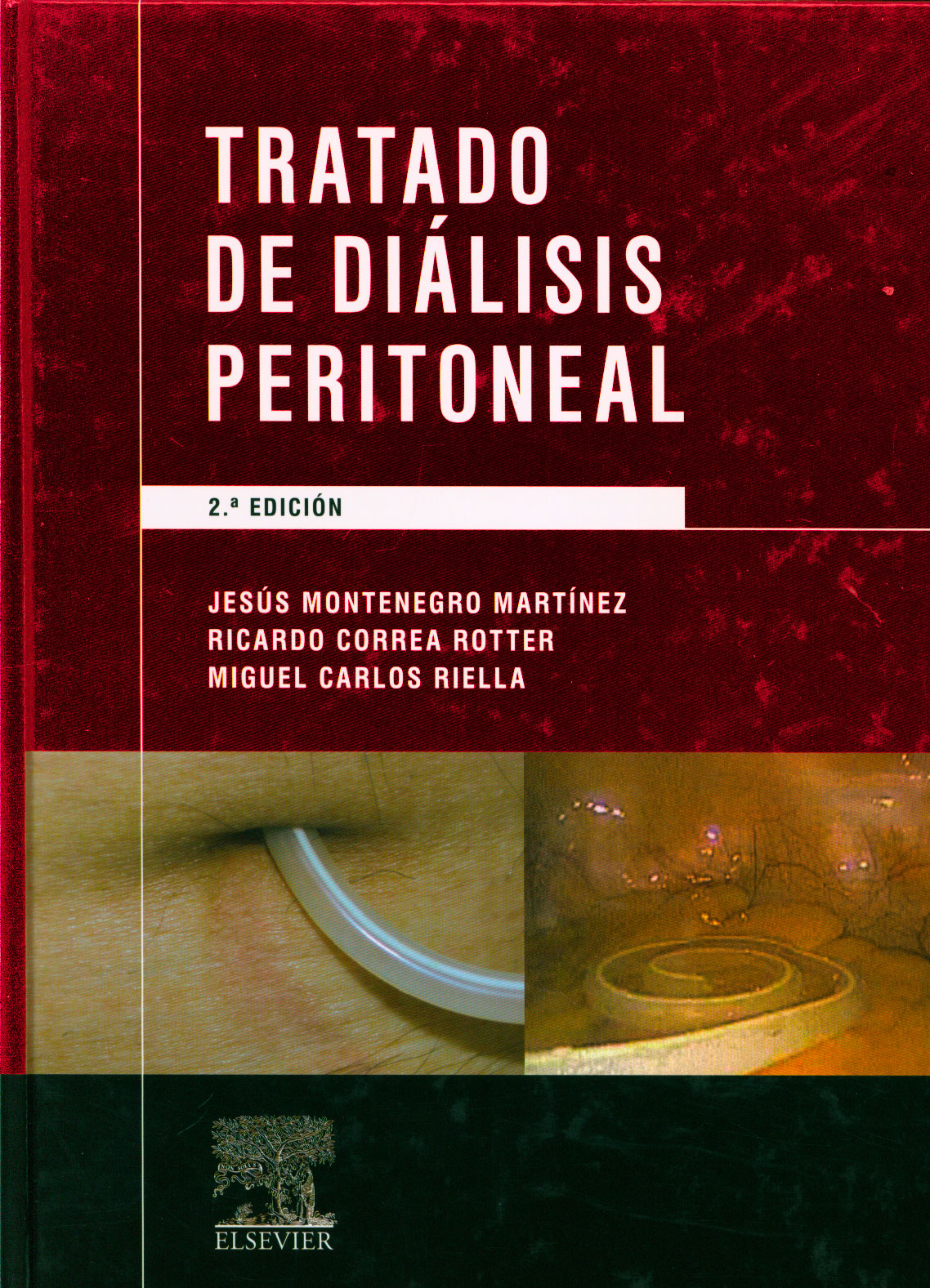 Tratado de diálisis peritoneal
      <i>es</i>