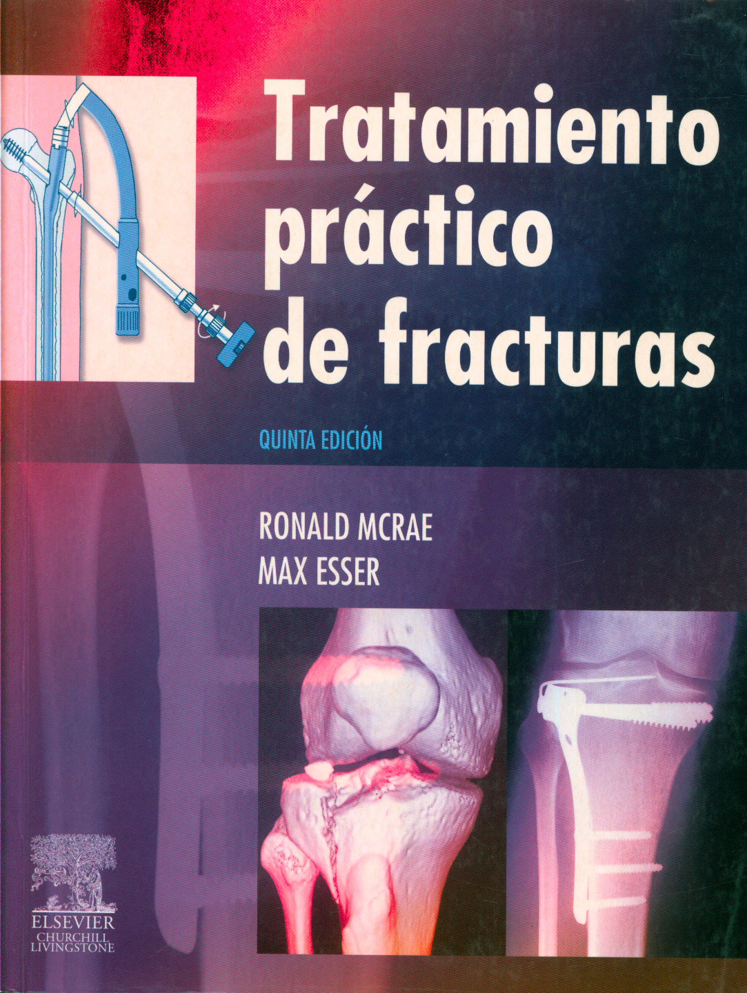 Tratamiento practico de fracturas
      <i>es</i>