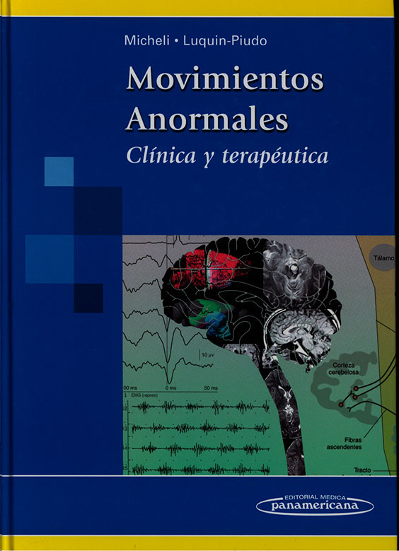 Movimientos anormales: clinica y terapeutica