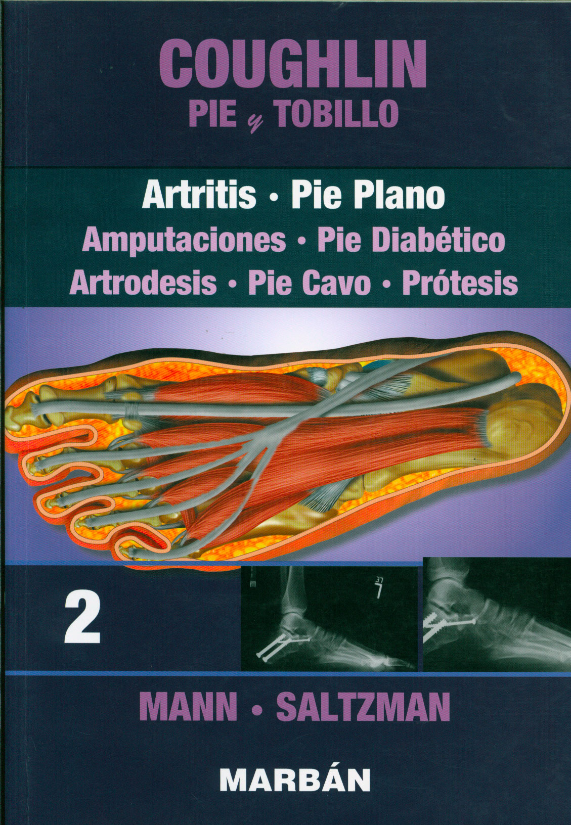 Pie y tobillo: artritis y pie plano
      <i>es</i>