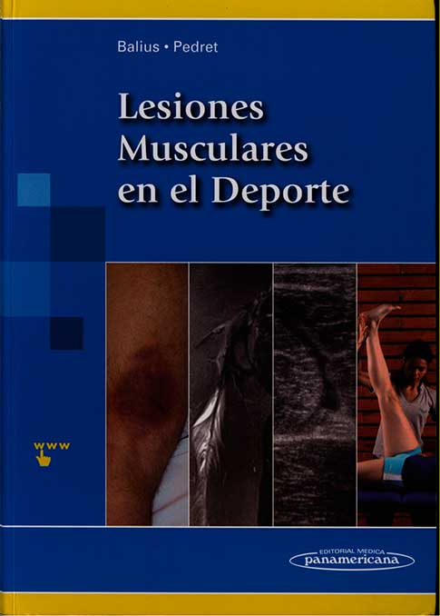 Lesiones musculares en el deporte