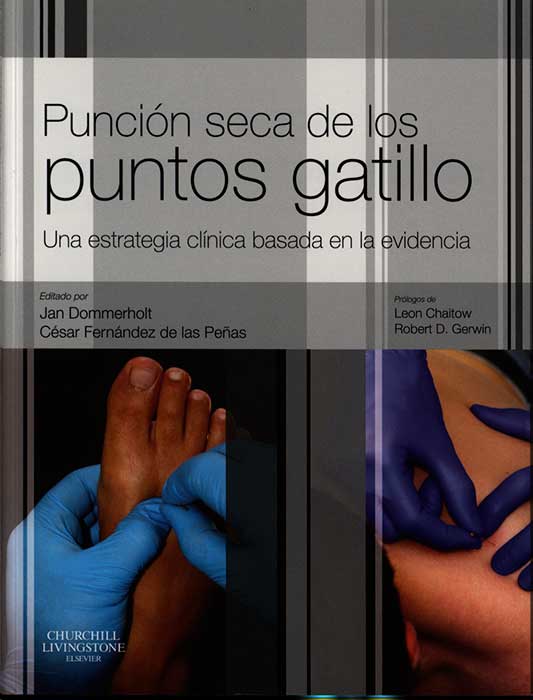 Punción seca de los puntos gatillo: una estrategia clinica basada en la evidencia