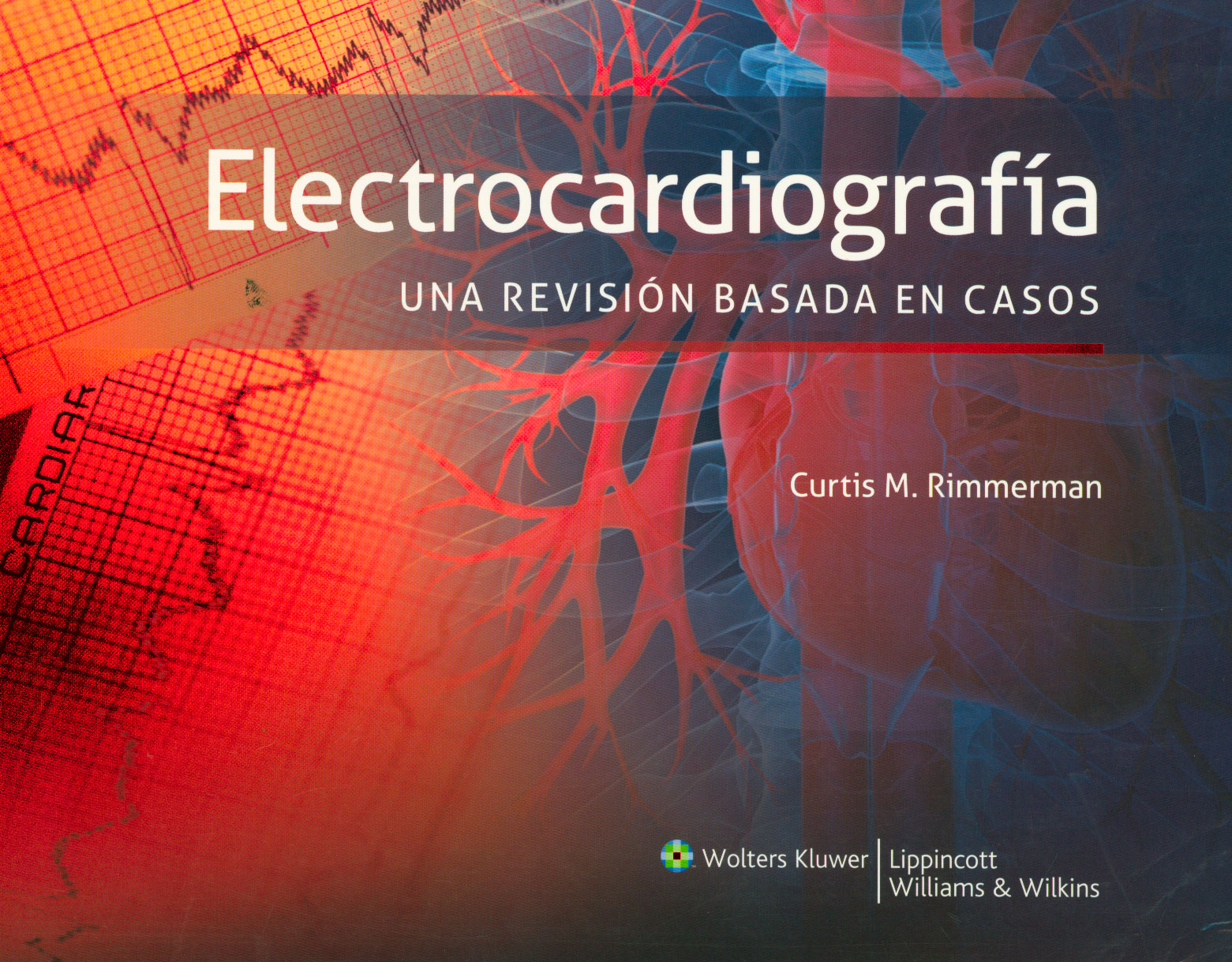 Electrocardiografía: una revisión basada en casos