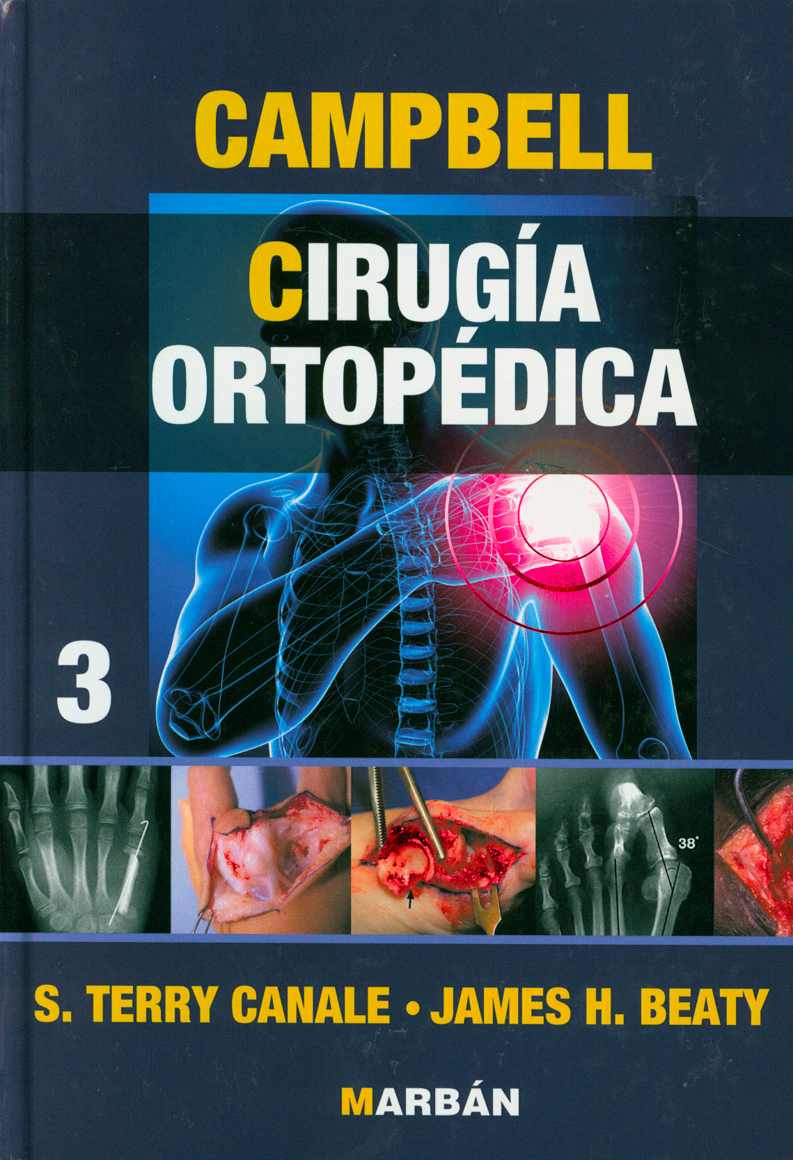 Cirugia Ortopedica Campbell