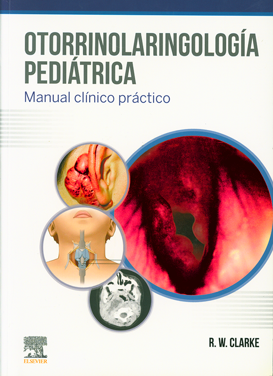 Otorrinolaringología pediátrica: Manual clínico práctico