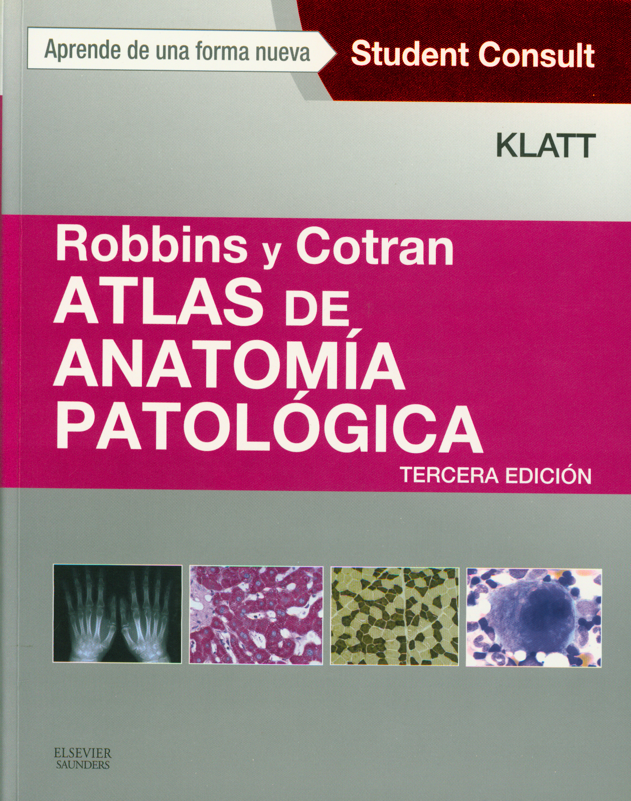 Atlas de anatomía patológica: Robbins y Cotran