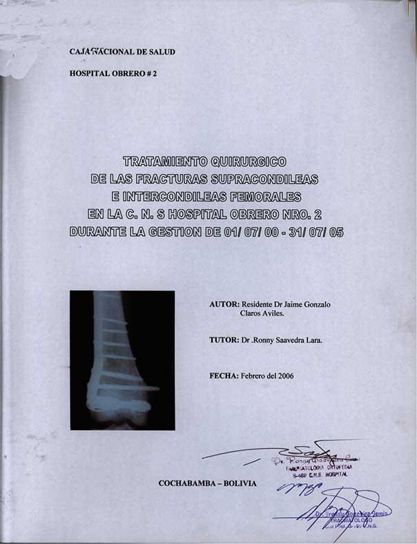 Tratamiento Quirurgico de las Fracturas supracondileas e Intercondileas Femorales en la CNS Hospital Obrero Nº 2 Durante la Gestión de 01/07/00 - 31/07/05