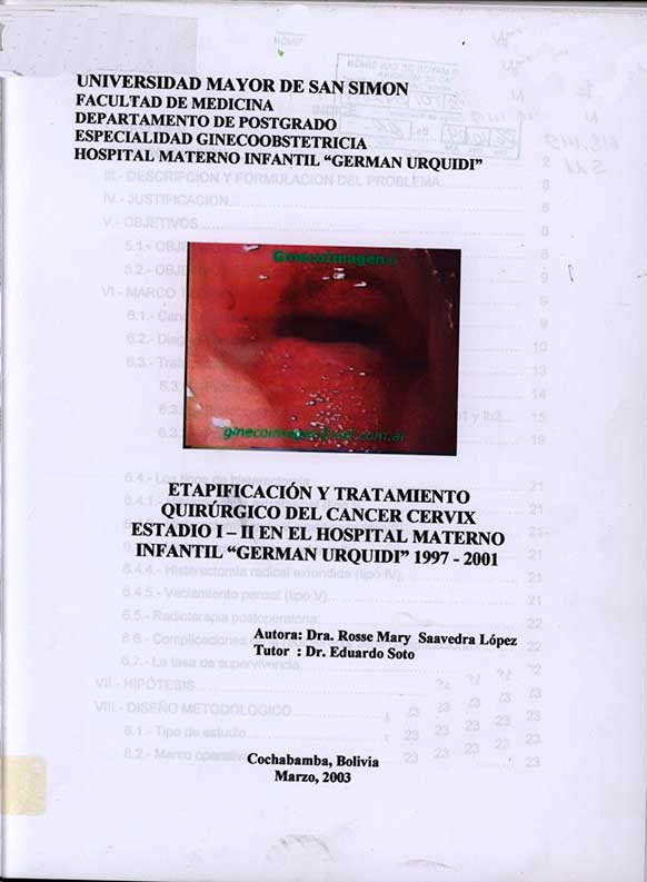 Etapificaciçon y tratamiento quirurgico del cancer cervix estadio I-II en el Hospital Materno Infantil German Urquidi 1997 2001