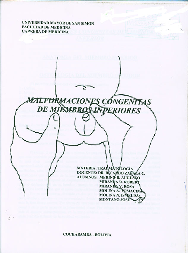 Malformaciones Congenitas de Mienbros Inferiores