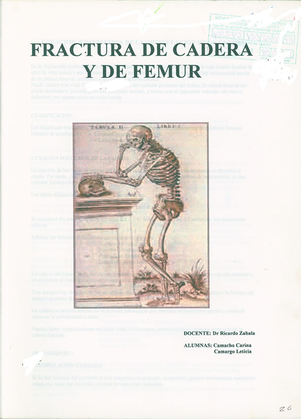 Fractura de Cadera y de Femur