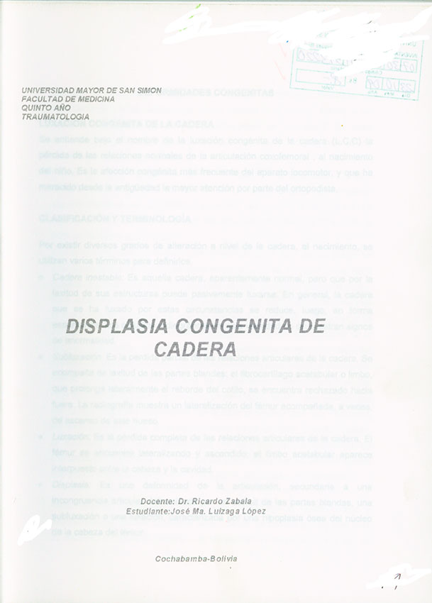 Displasia Congenita de Cadera
