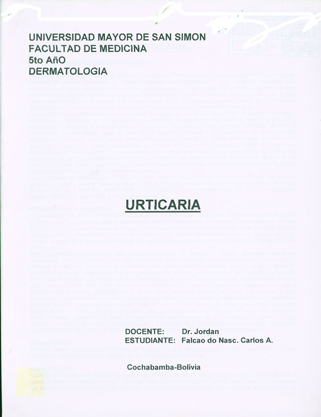 Urticaria