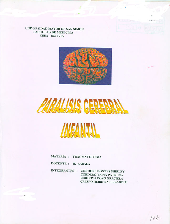 Parálisis cerebral Infantil